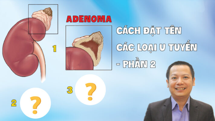 ADENOMA CACH DAT TEN CAC LOAI U TUYEN PHAN 2 01