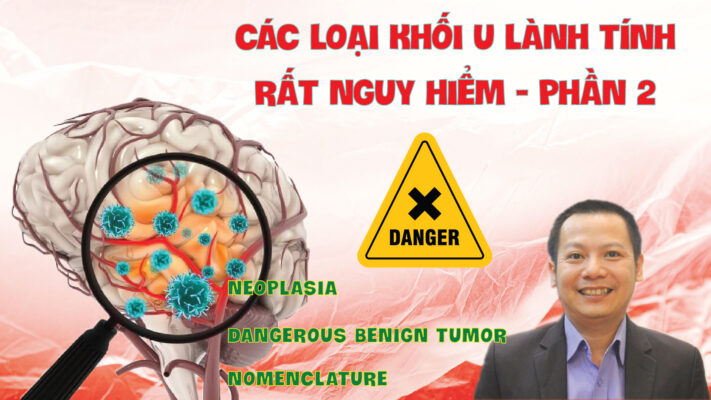 CAC LOAI KHOI U LANH TINH RAT NGUY HIEM PHAN 2 01