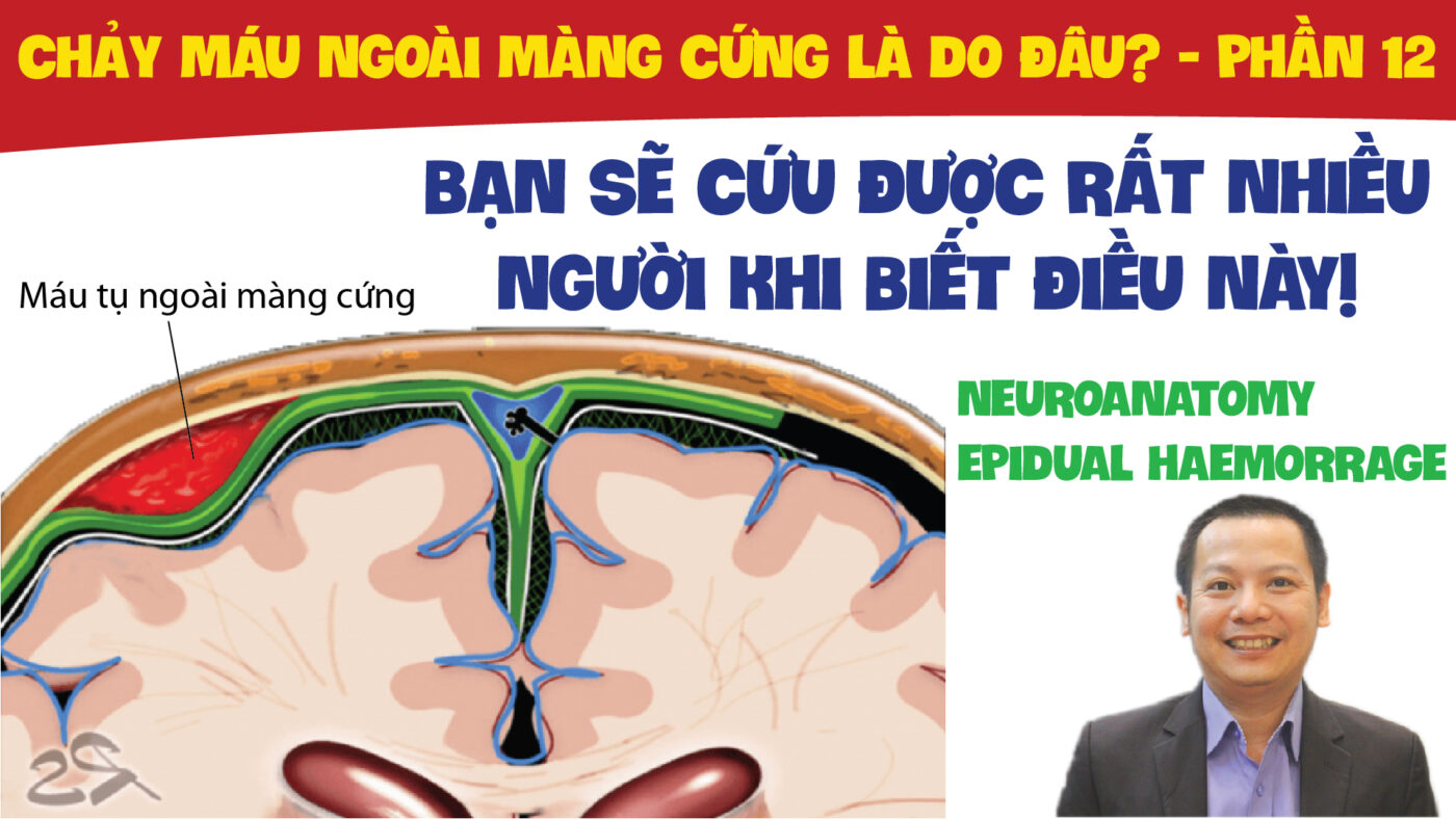 NEUROANATOMY EPIDUAL HAEMORRAGE CHAY MAU NGOAI MANG CUNG LA DO DAU PHAN 12 01 01