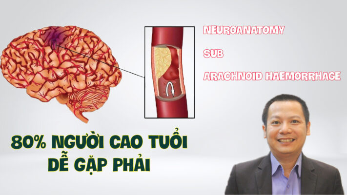 NEUROANATOMY SUB ARACHNOID HAEMORRHAGE CHAY MAU DUOI MANG NHEN LA DO DAU Phan 14 01