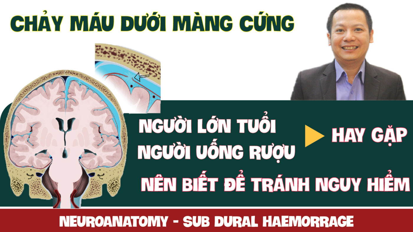 NEUROANATOMY SUB DURAL HAEMORRAGE CHAY MAU DUOI MANG CUNG DO DAU PHAN 13 01 01