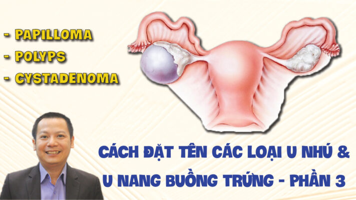 PAPILLOMA POLYPS CYSTADENOMA CACH DAT TEN CAC LOAI U NHU VA U NANG BUONG TRUNG PHAN 3 01