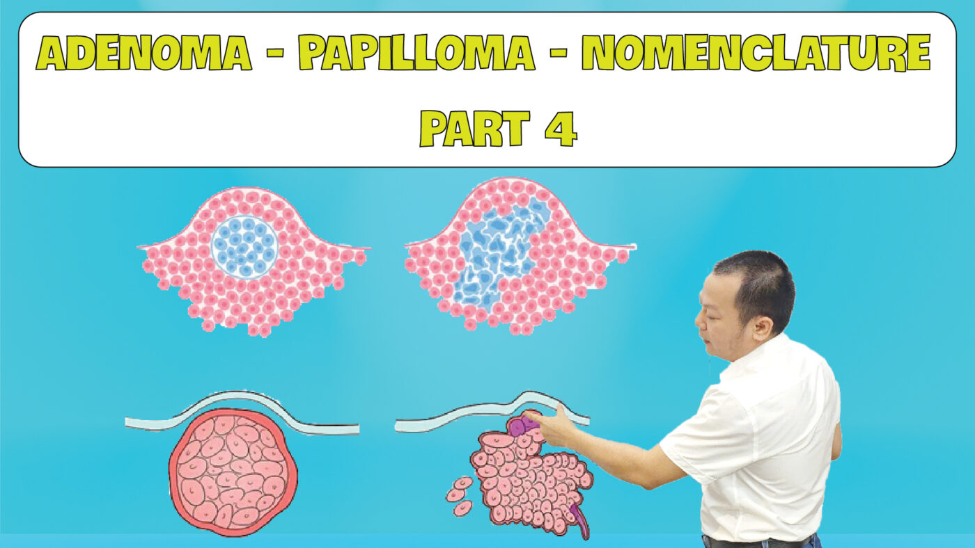 ADENOMA PAPILLOMA NOMENCLATURE part 4 01 01