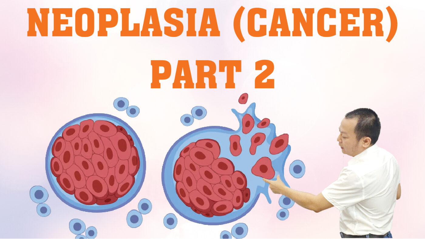 NEOPLASIA CANCER PART 2 01