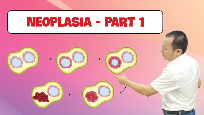 NEOPLASIA PART 1 01